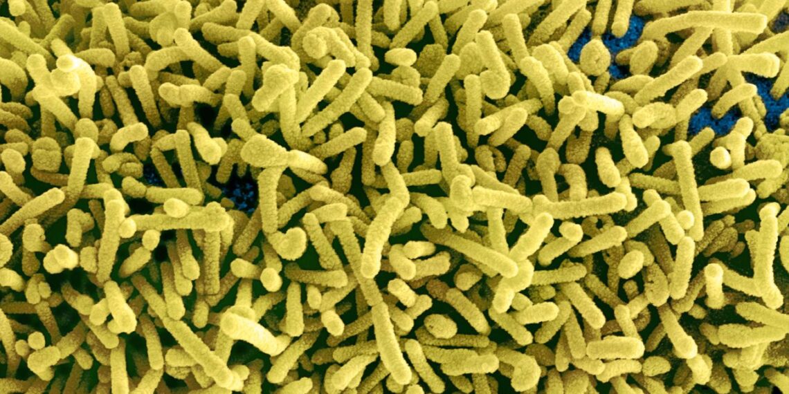 Colorized scanning electron micrograph of Marburg virus particles (yellow) both budding and attached to the surface of infected VERO E6 cells (blue).   (Getty Images)