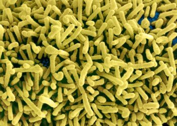 Fears as Marburg virus hits Guinea in West Africa