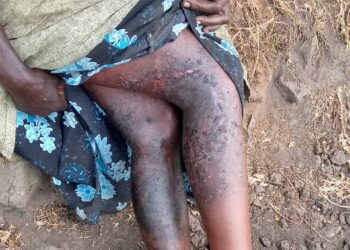 Well -wishers in Kisoro support Struggling family after hearing sad story on Voice of Muhabura