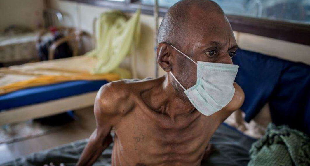 TB patient