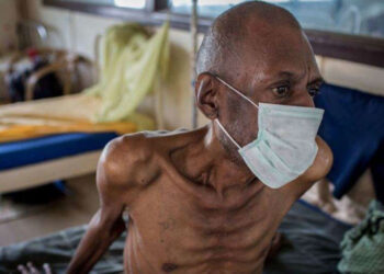 Kisoro Health Officials Raise Alarm over Rising Tuberculosis Cases, Warn Against Vaccine Misinformation